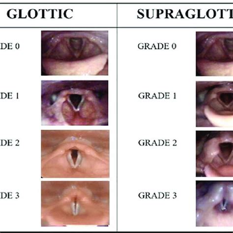 Continuous Laryngoscopy Exercise Grading System Reproduced With