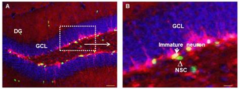 Adult Neurogenesis In The Dentate Gyrus Of Hippocampal Complex A A