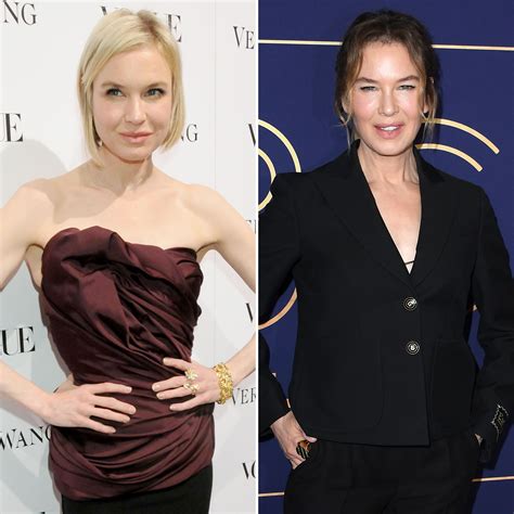 Renee Zellweger's Shocking Face Transformation [Photos] | In Touch Weekly