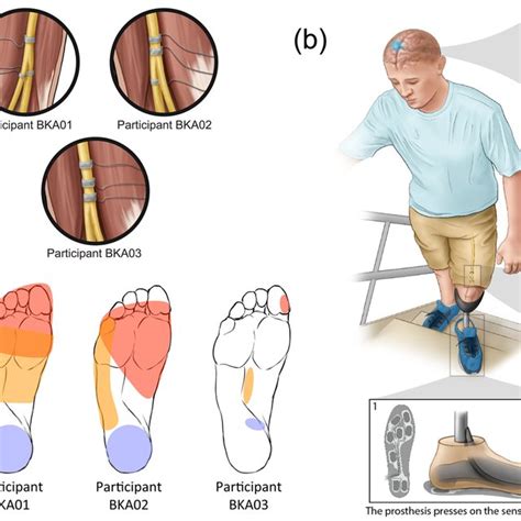 Closed Loop Somatosensory Neuroprosthesis A Location Of Nerve Cuff