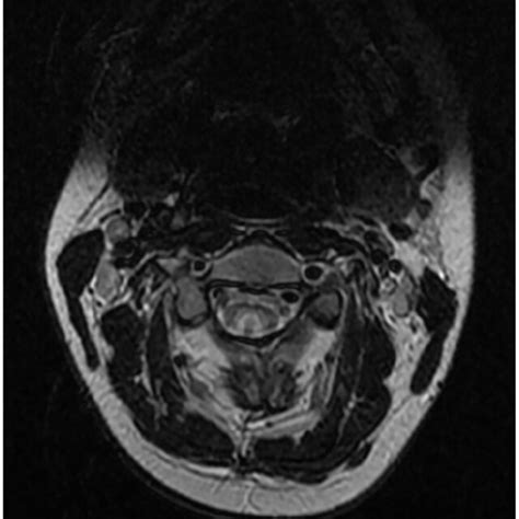 Early Sagittal T2 Weighted Mri Download Scientific Diagram