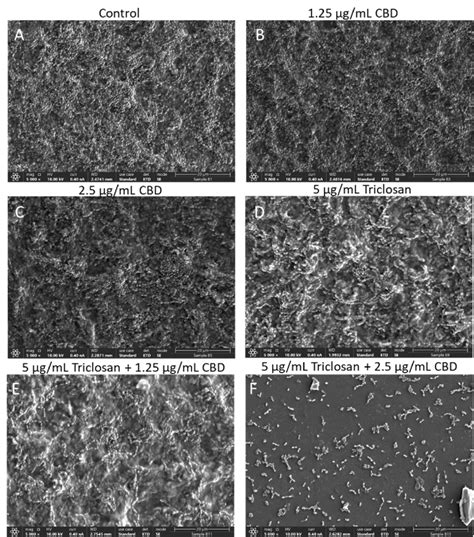 High Resolution Scanning Electron Microscope Hr Sem Images Of S