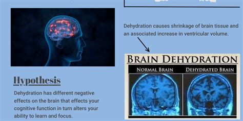 Effects of dehydration on the Brain infographic - Infogram