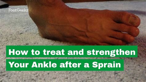 How To Treat And Strengthen Your Ankle After A Sprain Youtube