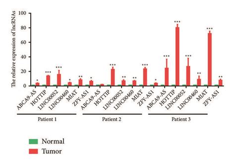 The Expression Of The Six Lncrnas In Hnscc A Hottip Expression Was