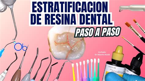 Estratificación de Resina Dental paso a paso resinas material