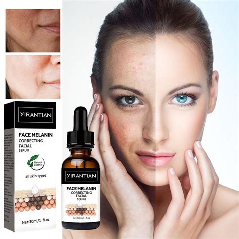 Whitening Freckle Serum Fade Melasma Dark Spots Remove Brighten Ml