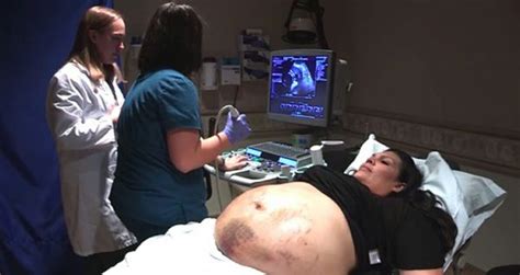 Mom Unexpectedly Conceived Quintuplets A Miracle Journey Readthisstory