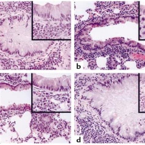 Lung Histology Of Ova Or Klh Immunized Balb C Mice After Transfer Of