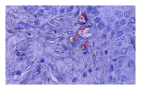 CD31 Immunostaining Of Burned Skin From Mice Untreated A Or Treated