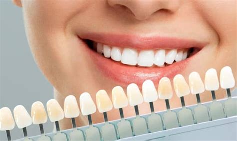 Why Porcelain Veneers Are The Perfect Solution For Dental Imperfections