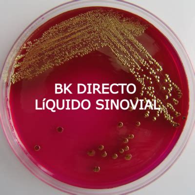 BK DIRECTO LÍQUIDO SINOVIAL OVLAB O V Laboratorios