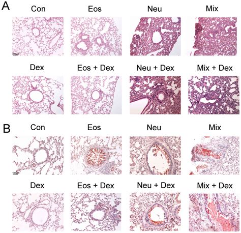 Establishment Of Different Experimental Asthma Models In Mice