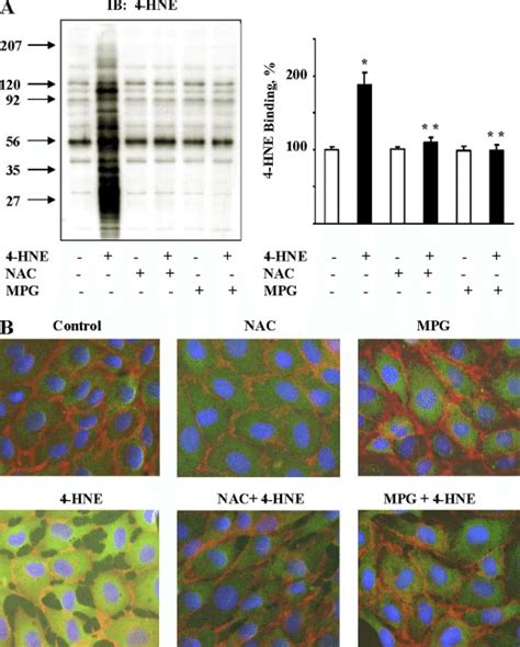 Effect Of Nac And Mpg On Hne Mediated Michael Adduct Formation In