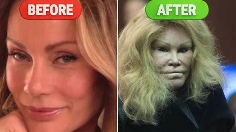 Celebrities Before And After Plastic Surgery Jocelyn Wildenstein