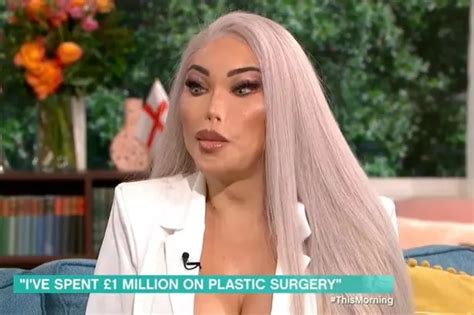 Human Barbie Shows Off New Look After Spending £1m On Plastic Surgery Liverpool Echo