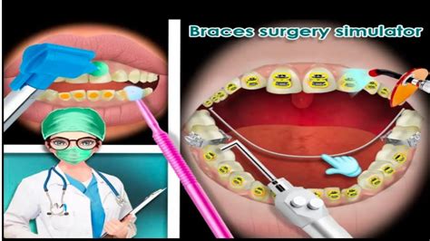 Asmr Simulator Game Braces Surgery Treatment Step By Step Chelle