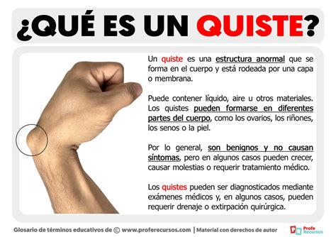 Qu Es Un Quiste Definici N De Quiste