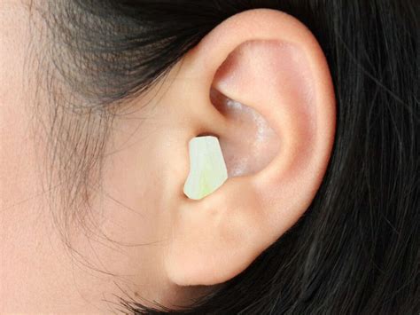 Bullous Myringitis: What Is Bullous Myringitis?
