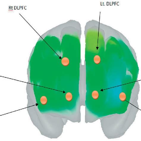 Region Of Interest In Right And Left Prefrontal Cortex Shown By 3d