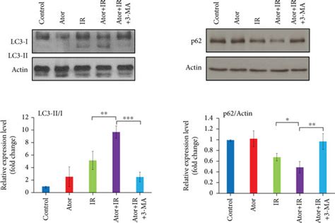 Atorvastatin Attenuates Rt Induced Injury And Apoptosis Of Intestinal