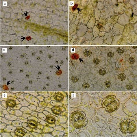 Transverse Section Of Root Of Three Species Of Brassica L A B B Rapa Download Scientific