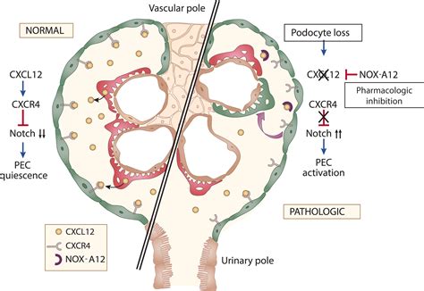 Awakening The Bowman Inhibition Of Cxcl12 Signaling Activates Parietal Epithelial Cells