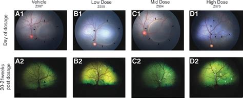 Figure From Toxicity And Efficacy Evaluation Of An Adeno Associated