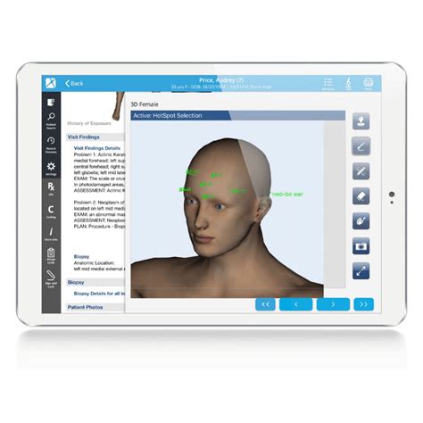 Software Dermatolog A Nextech Para Historias Cl Nicas De