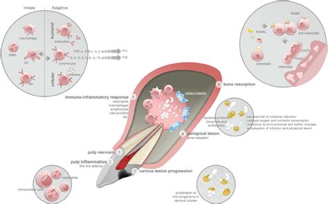 Schematic Fi Gure Of Pulp And Periapical Pathology Evolution 1