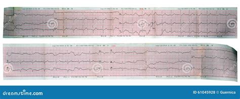 Echocardiogram Ecg Ekg Heart Reading Stock Photo Image 61045928