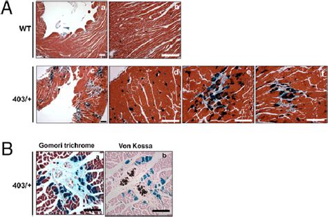 Focal Mef2 Reporter Activation In Myocytes Adjacent To Regions Of