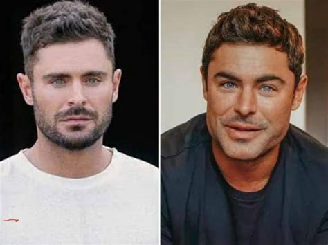 Fratura na mandíbula entenda a mudança no rosto do ator Zac Efron