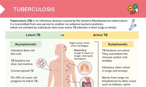 Tuberculosis Free Cheat Sheet Lecturio