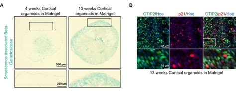 Robust And Highly Reproducible Generation Of Cortical Brain Organoids