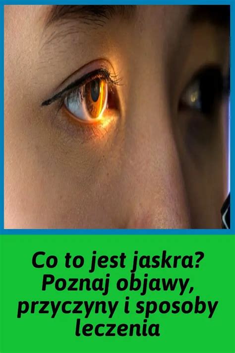 Co To Jest Jaskra Poznaj Objawy Przyczyny I Sposoby Leczenia