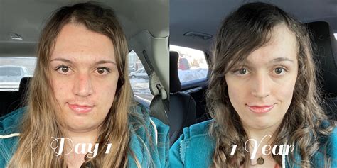 27 28 Mtf 1 Year Hrt Day 1 Vs 1 Year I Lost 80 Pounds And My Skin Is