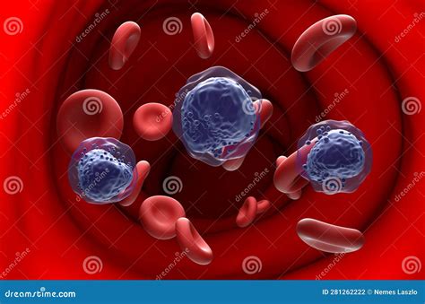 Acute Myeloid Leukemia Aml Cells In Blood Flow Section View D