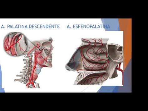 Angiofibroma Nasofar Ngeo Juvenil Youtube