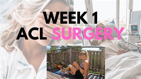 First Week After Acl Surgery Acl Vlog 2 Youtube