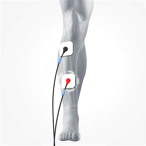 Tibialis Anterior Motor Point Chart Kanmer