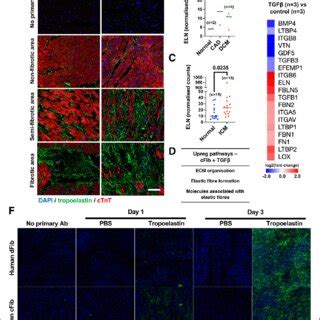 Tropoelastin Is Increased In Ischemic Human Heart Disease And In Human