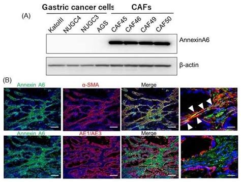 Molecule Secreted By Cancer Associated Fibroblasts Promotes Anticancer