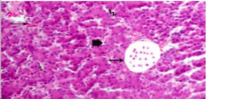 A Photomicrograph Of Liver Section Of T2 3 Week Of Age Showing The