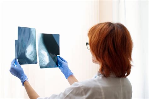 How to Read a Mammogram Report - Health Images