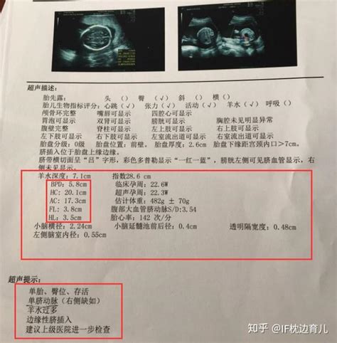 孕妈咪做四维彩超，能懂报告单上几组数据，胎儿就没小秘密了 知乎