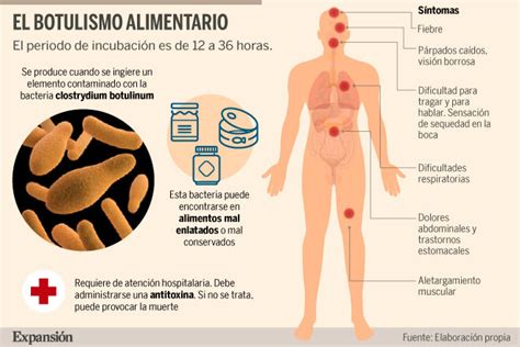 Qué es el botulismo y cuáles son sus efectos Sociedad