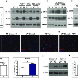 Spla Iia Induced C Jun Mediates Altered Ap Signalling Enhances