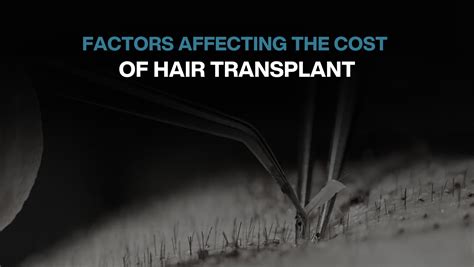 Factors Affecting The Cost Of Hair Transplant Bluemagic Group