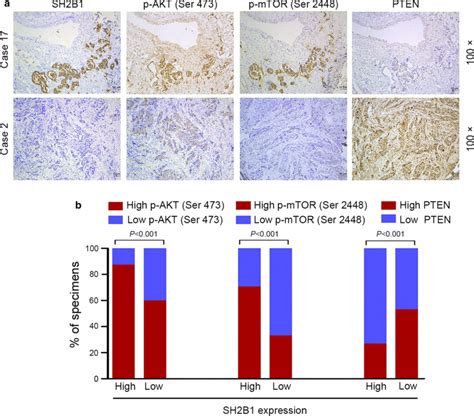 Clinical Relevance Of SH2B1 And Its Targets In NSCLC A Representative